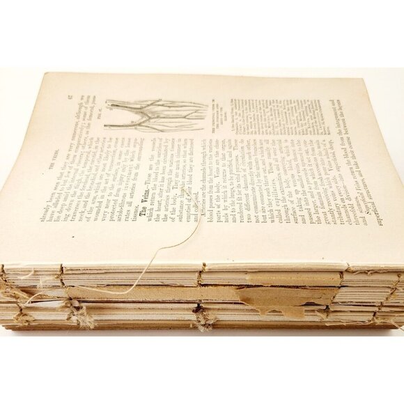 1893 Cottage Physician Victorian Ephemera Lot Of 300 Pcs Medical 1st Aid LGDWB3 - Picture 9 of 9